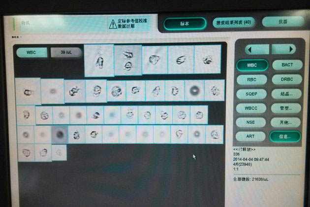 美(měi)國(guó)IQ 樣本測試圖 白(bái)細胞